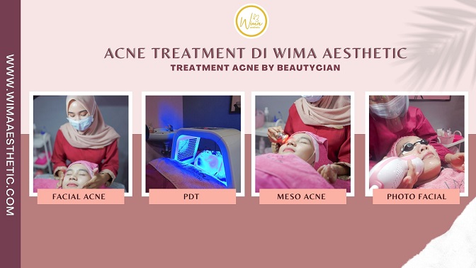 ACNE TREATMENT DI PEMALANG