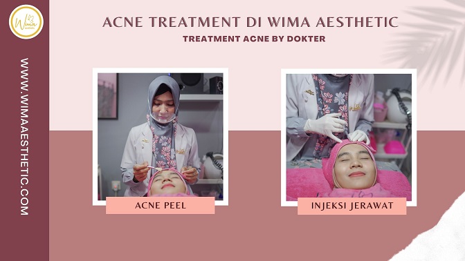 ACNE TREATMENT DI PEMALANG