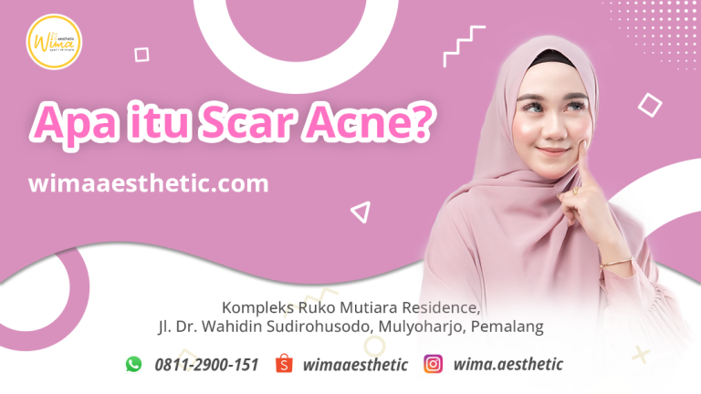 Apa itu Scar Acne