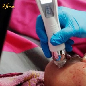 Ultimate Recovery Rejuve with Growth Factor