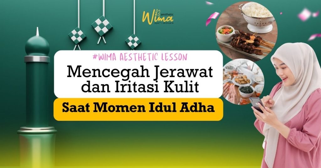 Wima Aesthetic Lesson : Mencegah Jerawat dan Iritasi Kulit Saat Momen Idul Adha