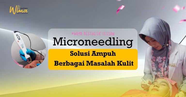 Microneedling, solusi ampuh mengatasi berbagai masalah kulit.